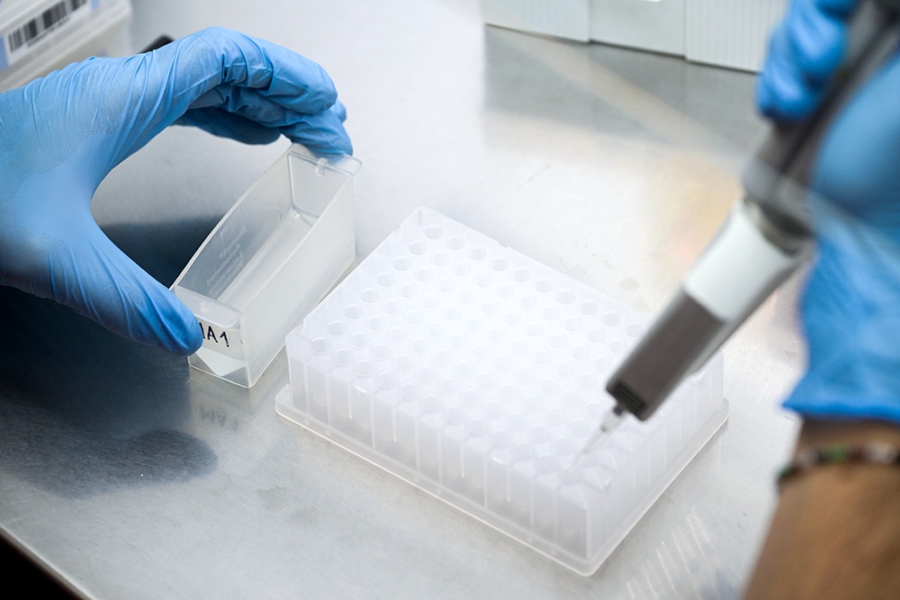 Российское лекарство повысило эффективность лечения лимфомы у пациентов с ВИЧ Российское лекарство повысило эффективность лечения лимфомы у пациентов с ВИЧ